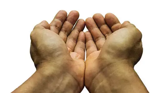 कोरोना घटे या न घटे... पर इमेज चमकती रहे !!! कोरोना घटे या न घटे... पर इमेज चमकती रहे !!!