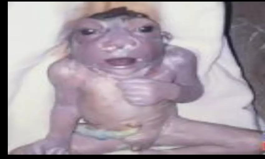 महिला ने दिया विचित्र शिशु को जन्म, पैदा होते ही हुई मौत