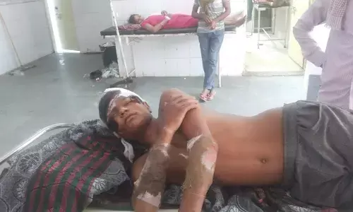 рдЖрдордиреЗ рд╕рд╛рдордиреЗ рдмрд╛рдЗрдХреЛрдВ рдХреА рдЯрдХреНрдХрд░ рдореЗрдВ рджреЛ рд▓рд╣реВрд▓реБрд╣рд╛рди рдЖрдордиреЗ рд╕рд╛рдордиреЗ рдмрд╛рдЗрдХреЛрдВ рдХреА рдЯрдХреНрдХрд░ рдореЗрдВ рджреЛ рд▓рд╣реВрд▓реБрд╣рд╛рди