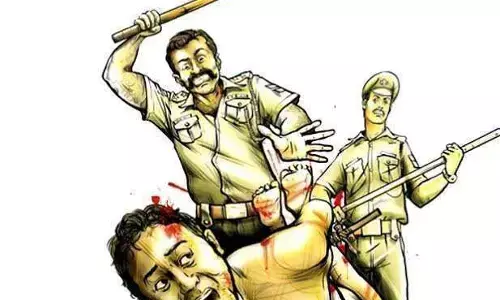 डिप्टी सीएम के खास समझे जाने वाले चौकी इंचार्ज ने दलित युवक को नग्न कर बेरहमी से पीटा! डिप्टी सीएम के खास समझे जाने वाले चौकी इंचार्ज ने दलित युवक को नग्न कर बेरहमी से पीटा!