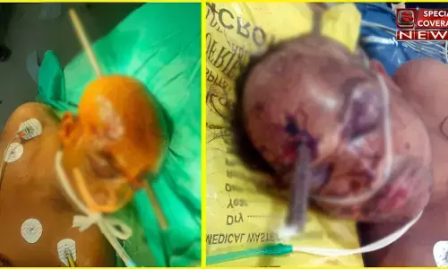 गाजियाबाद : सिर के आर-पार हुआ सरिया, ऐसा हाल देखकर डॉ के भी छूटे पसीने! तस्वीरें देखकर कांप जाएंगे गाजियाबाद : सिर के आर-पार हुआ सरिया, ऐसा हाल देखकर डॉ के भी छूटे पसीने! तस्वीरें देखकर कांप जाएंगे