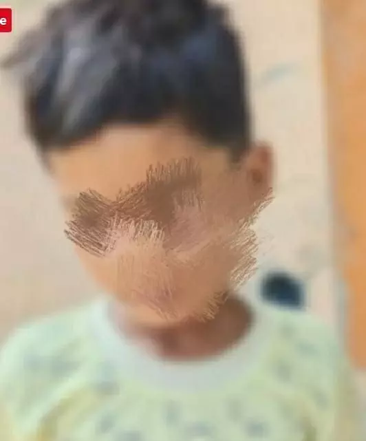 सौतेले बाप ने 8 साल के मासूम को पापा न कहने पर दी ख़ौफ़नाक सज़ा, प्राइवेट पार्ट को जलती बीड़ी से जलाया सौतेले बाप ने 8 साल के मासूम को पापा न कहने पर दी ख़ौफ़नाक सज़ा, प्राइवेट पार्ट को जलती बीड़ी से जलाया