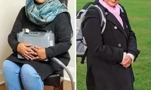 दुनिया की सबसे दुर्लभ महिला, जिसके पास अपना दिल नहीं दुनिया की सबसे दुर्लभ महिला, जिसके पास अपना दिल नहीं