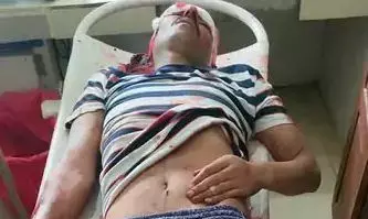 रायफल से अचानक चली गोली जवान के सर पर लगी, मौके पर मौत