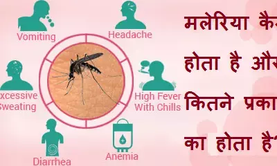 दुनिया की पहली मलेरिया वैक्सीन अत्यंत महत्वपूर्ण पर रोग उन्मूलन के लिए काफ़ी नहीं