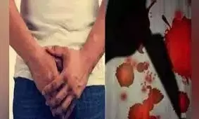 डॉक्टरों को काटना पड़ा युवक का प्राइवेट पार्ट, युवक ने आपबीती बताई डॉक्टरों को काटना पड़ा युवक का प्राइवेट पार्ट, युवक ने आपबीती बताई