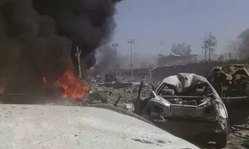Bomb blast Military Hospital in Kabul: काबुल में मिलिट्री हॉस्पिटल के सामने बम ब्लास्ट, 19की मौत 50 घायल Bomb blast Military Hospital in Kabul: काबुल में मिलिट्री हॉस्पिटल के सामने बम ब्लास्ट, 19की मौत 50 घायल