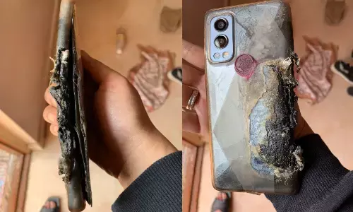 बम की तरह फटा ये स्मार्टफोन, गंभीर रूप से घायल हुआ यूजर की जांघ बम की तरह फटा ये स्मार्टफोन, गंभीर रूप से घायल हुआ यूजर की जांघ