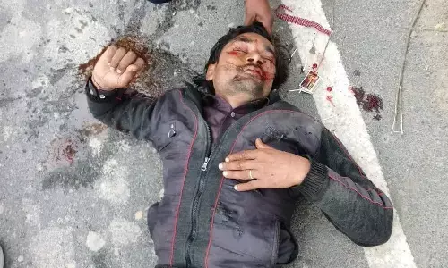 सड़क किनारे की झाड़ियां बनी जानलेवा, नीलगाय की टक्कर से बाइक सवार घायल सड़क किनारे की झाड़ियां बनी जानलेवा, नीलगाय की टक्कर से बाइक सवार घायल