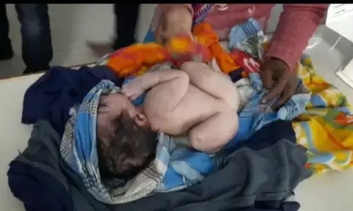 बिहार में अनोखे बच्चे का जन्म जिसके तीन हाथ, तीन पैर है, देखने वालों की लगी भीड़ बच्चे की हालत नाजुक!