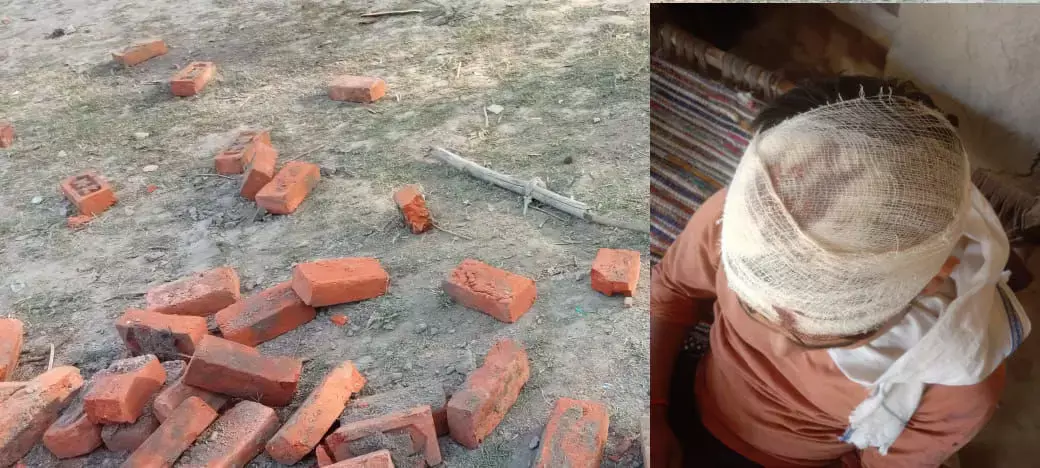 Ayodhya News: खड़ंजा निर्माण में चटकी लाठियां, आधा दर्जन से अधिक लोग हुए घायल