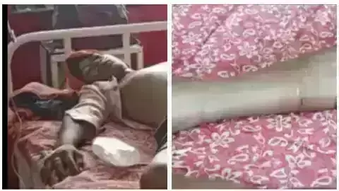 बीमारी का इलाज करने के लिए युवक को गर्म लोहे से दागा, तबियत बिगड़ने पर अस्पताल में किया भर्ती बीमारी का इलाज करने के लिए युवक को गर्म लोहे से दागा, तबियत बिगड़ने पर अस्पताल में किया भर्ती