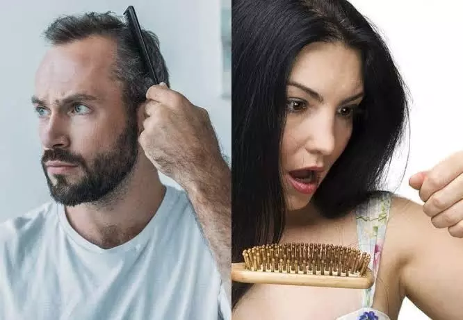 Hair Fall: हेयर फॉल की समस्या को खत्म करने के लिए इन चीजों को करें अपनी प्लेट में शामिल Hair Fall: हेयर फॉल की समस्या को खत्म करने के लिए इन चीजों को करें अपनी प्लेट में शामिल