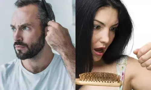 Hair Fall: हेयर फॉल की समस्या को खत्म करने के लिए इन चीजों को करें अपनी प्लेट में शामिल Hair Fall: हेयर फॉल की समस्या को खत्म करने के लिए इन चीजों को करें अपनी प्लेट में शामिल