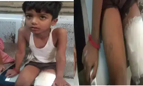 स्कूल वैन का रेडिएटर फटने से दो बच्चे झुलसे, मची चीख-पुकार