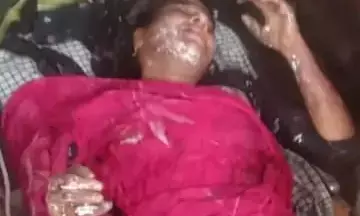 कैराना में महिला पर डाला तेजाब, हायर सेंटर रेफर