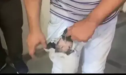 जेब में रखा मोबाइल फटा, जख्मी युवक को ले जाना पड़ा अस्पताल, जानें कैसे हुआ ये सब जेब में रखा मोबाइल फटा, जख्मी युवक को ले जाना पड़ा अस्पताल, जानें कैसे हुआ ये सब