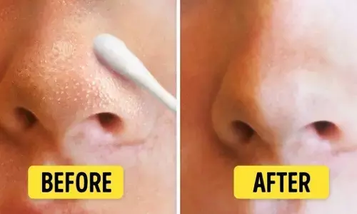 1 चम्मच बेसन से हल करें अपनी ये तीन समस्याएं, चेहरे की खोई रंगत वापस लौटाने के लिए करें ये आसान उपाय