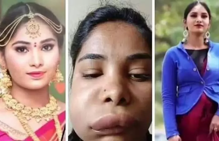 सर्जरी के बाद ऐसा बिगड़ा एक्ट्रेस का चेहरा कि पहचानना हुआ मुश्किल, अब घर से बाहर भी नहीं निकल रही सर्जरी के बाद ऐसा बिगड़ा एक्ट्रेस का चेहरा कि पहचानना हुआ मुश्किल, अब घर से बाहर भी नहीं निकल रही