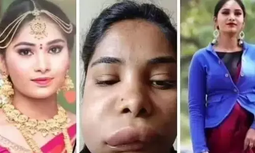 सर्जरी के बाद ऐसा बिगड़ा एक्ट्रेस का चेहरा कि पहचानना हुआ मुश्किल, अब घर से बाहर भी नहीं निकल रही