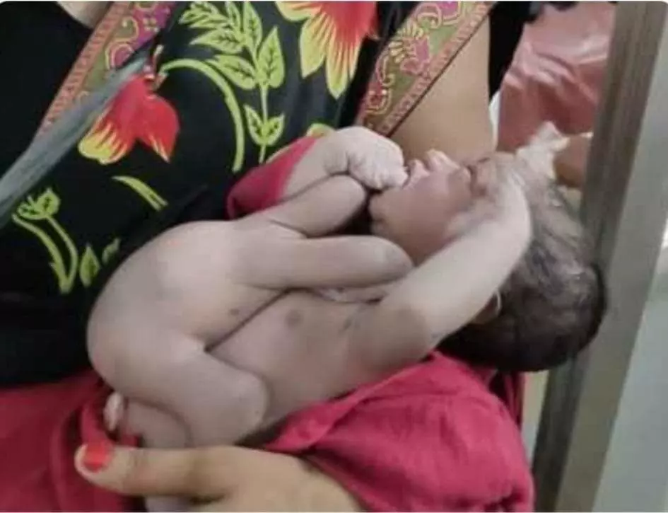 महिला ने 4-4 हाथ- पैर वाली बच्ची को दिया जन्म, डॉक्टर्स भी रह गए हैरान