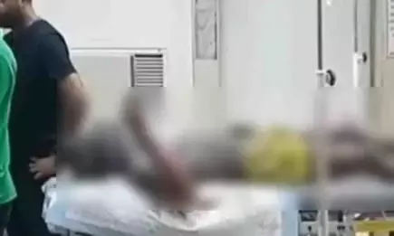 बिल्डर ने ठेकेदार को पेट्रोल डालकर जिंदा जलाया, इलाज के दौरान मौत बिल्डर ने ठेकेदार को पेट्रोल डालकर जिंदा जलाया, इलाज के दौरान मौत