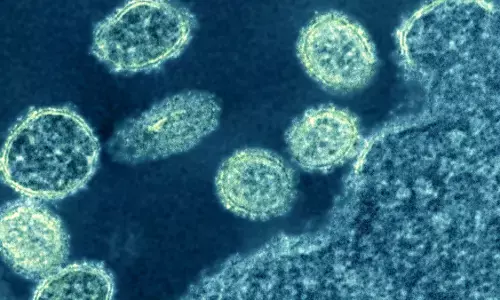 Mumbai Swine Flu: मुंबई में स्वाइन फ्लू के मामलों में इजाफा, जानें लक्षण और बचाव के उपाय Mumbai Swine Flu: मुंबई में स्वाइन फ्लू के मामलों में इजाफा, जानें लक्षण और बचाव के उपाय