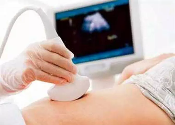 भ्रूण लिंग का परीक्षण करते दो आरोपी गिरफ्तार, नर्सिगं होम किया सील भ्रूण लिंग का परीक्षण करते दो आरोपी गिरफ्तार, नर्सिगं होम किया सील