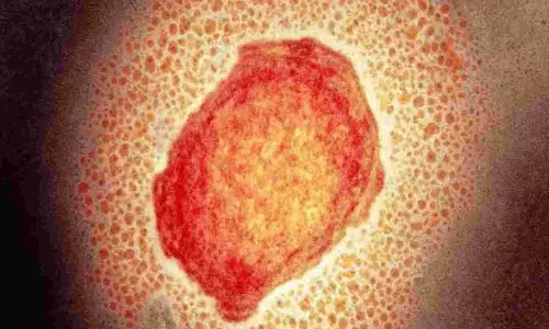 Monkeypox Death: तेजी से बढ़ रहा है मंकीपॉक्स का खतरा, देश में पहली मौत
