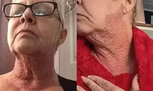 ब्यूटी पॉर्लर में 5 लाख खर्च करने के बाद महिला बन गई छिपकली, जानें आखिर क्या हुआ… ब्यूटी पॉर्लर में 5 लाख खर्च करने के बाद महिला बन गई छिपकली, जानें आखिर क्या हुआ…