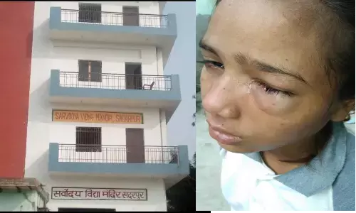 नोएडा: हैंड राइटिंग खराब होने पर दूसरी कक्षा में पढ़ने वाली शालू को टीचर ने डंडे से पिटाई की नोएडा: हैंड राइटिंग खराब होने पर दूसरी कक्षा में पढ़ने वाली शालू को टीचर ने डंडे से पिटाई की