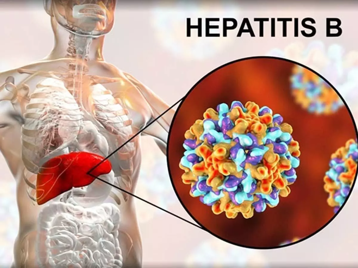 hepatitis b, hepatitis c, hepatitis test, hepatitis disease, hepatitis patients in india, since when in india, india news, india breaking news, special coverage news, hepatitis special report,हेपेटाइटिस बी , हेपेटाइटिस सी , हेपेटाइटिस की जांच , हेपेटाइटिस बीमारी , भारत में हेपेटाइटिस के मरीज , भारत में कब से , भारत सम� hepatitis b, hepatitis c, hepatitis test, hepatitis disease, hepatitis patients in india, since when in india, india news, india breaking news, special coverage news, hepatitis special report,हेपेटाइटिस बी , हेपेटाइटिस सी , हेपेटाइटिस की जांच , हेपेटाइटिस बीमारी , भारत में हेपेटाइटिस के मरीज , भारत में कब से , भारत सम�