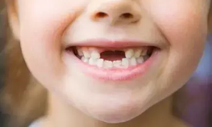 टूटे दांत को क्यों फेंक देतें है लोग जानिए क्या है रहस्य