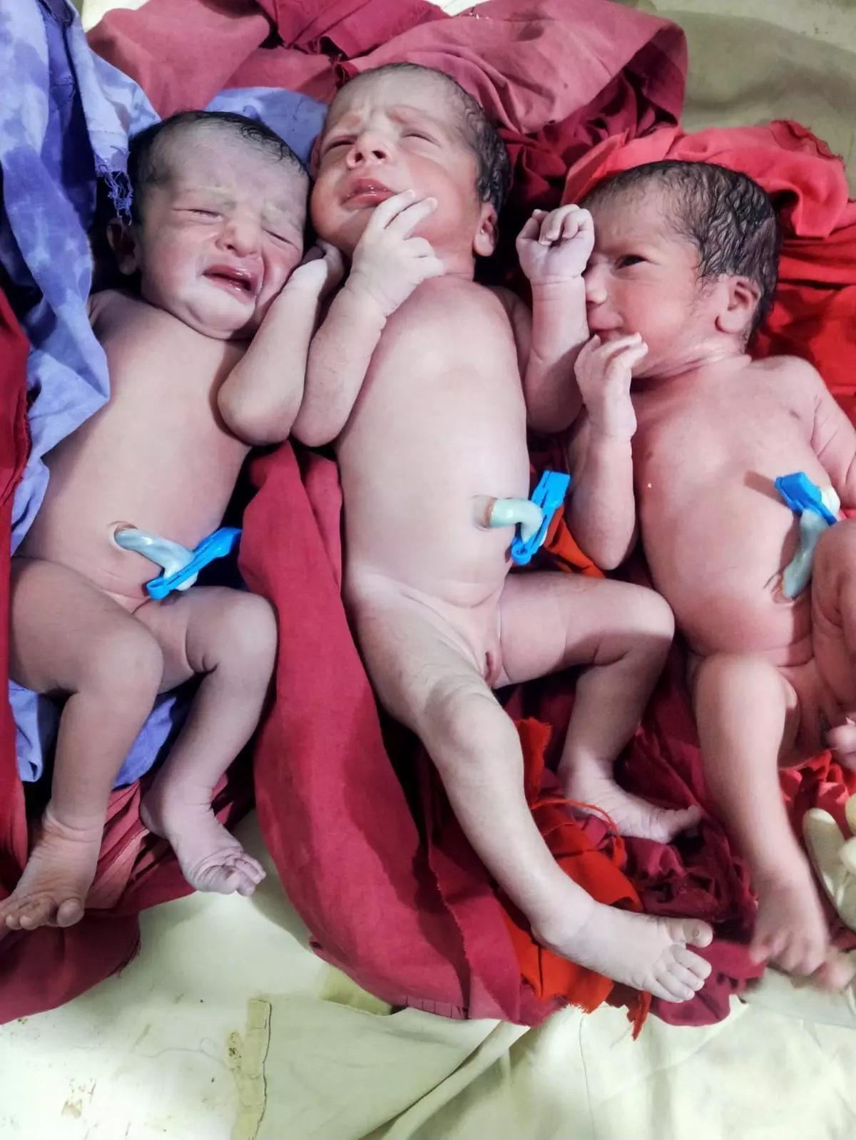 कुदरत का करिश्मा एक साथ तीन नवजात शिशुओं को दिया जन्म, जच्चा और बच्चा दोनों सुरक्षित कुदरत का करिश्मा एक साथ तीन नवजात शिशुओं को दिया जन्म, जच्चा और बच्चा दोनों सुरक्षित