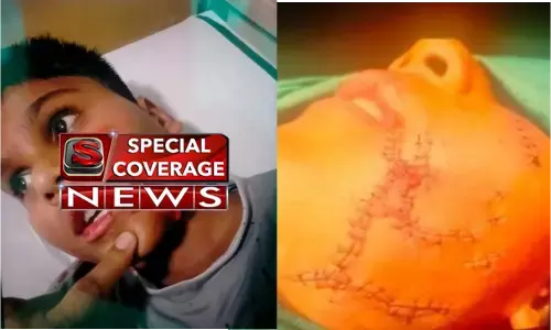 गाजियाबाद में कुत्तों का आतंक: 11 वर्षीय बच्चे पर पिटबुल डॉग ने जानलेवा हमला किया है.बच्चे के चेहरे पर करीब 200 टांके आए गाजियाबाद में कुत्तों का आतंक: 11 वर्षीय बच्चे पर पिटबुल डॉग ने जानलेवा हमला किया है.बच्चे के चेहरे पर करीब 200 टांके आए