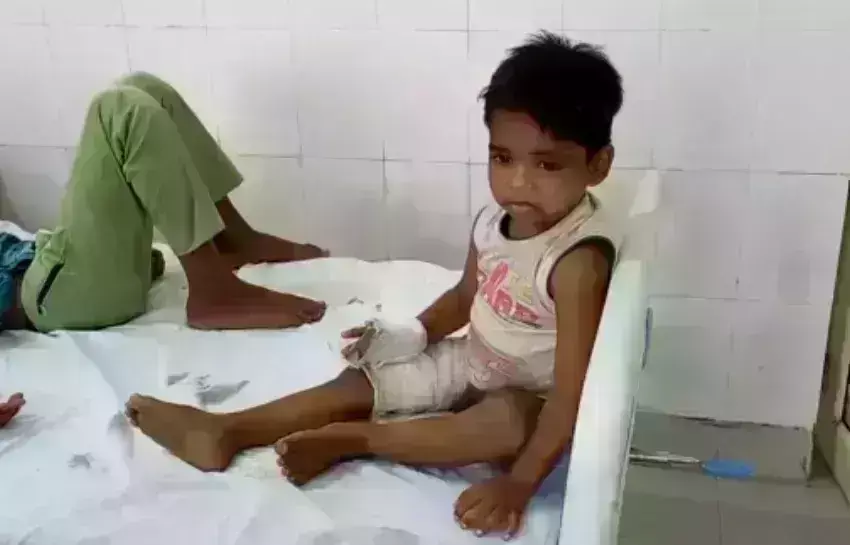 कासगंज जिले में आवारा कुत्तों का आतंक, 4 साल की मासूम पर किया हमला कासगंज जिले में आवारा कुत्तों का आतंक, 4 साल की मासूम पर किया हमला