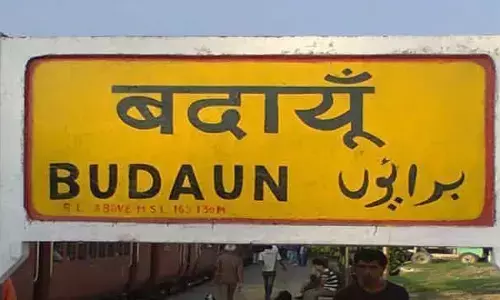 नाबालिक अपनी मां को दबाई दिलबाने के लिए सीएससी हॉस्पिटल पहुंचा वहां पर खडी कार मे खरोच लग जाने के कारण महिला डाक्टर ने बुरी तरह पीटा