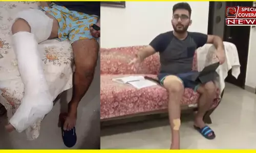 गाजियाबाद में रॉट विलर कुत्ते ने युवक के पैर को ऐसे काटा कि करानी पड़ी सर्जरी, 20 मीटर घसीटा: मांस नोंचने तक नहीं छोड़ा, FIR दर्ज गाजियाबाद में रॉट विलर कुत्ते ने युवक के पैर को ऐसे काटा कि करानी पड़ी सर्जरी, 20 मीटर घसीटा: मांस नोंचने तक नहीं छोड़ा, FIR दर्ज