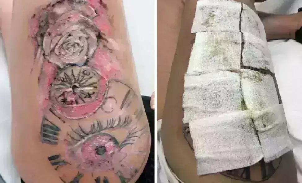 महिला ने इस जगह छपबा लिया टैटू की फिर हुआ यह महिला ने इस जगह छपबा लिया टैटू की फिर हुआ यह