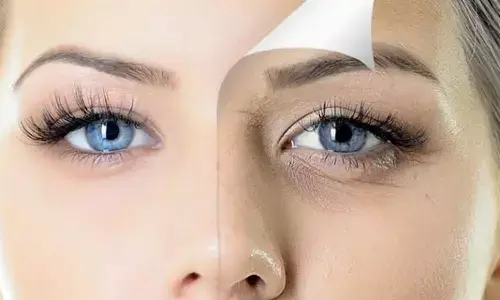 Dark Circle Removal Tips: अब मिनटों में गायब होंगे आंखों के नीचे से डार्क सर्कल, 5 घरेलू नुस्खे आएंगे बहुत काम Dark Circle Removal Tips: अब मिनटों में गायब होंगे आंखों के नीचे से डार्क सर्कल, 5 घरेलू नुस्खे आएंगे बहुत काम