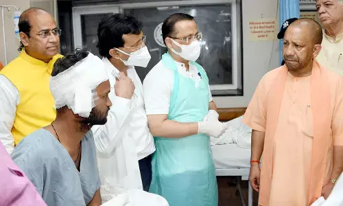 कानपुर घायलों को देख भावुक हुए सीएम योगी कानपुर घायलों को देख भावुक हुए सीएम योगी