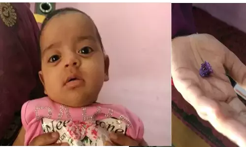 गाजियाबाद : 5 महीने की रिया ने खेलते समय बालों में लगाने वाले क्लेचर को निगल लिया