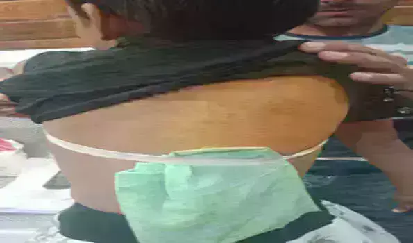 शिक्षको का टॉयलेट इस्तेमाल करने को लेकर 7 बर्षीय नाबालिक छात्रा को बेरहमी से पीटा थाने मे दर्ज नही हुआ मामला ... शिक्षको का टॉयलेट इस्तेमाल करने को लेकर 7 बर्षीय नाबालिक छात्रा को बेरहमी से पीटा थाने मे दर्ज नही हुआ मामला ...