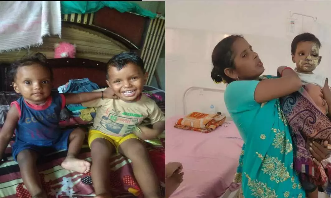 कलयुगी पिता ने बर्थडे पार्टी में खाना कम बनने से नाराज होकर अपने दो मासूम बच्चों के ऊपर पेट्रोल डालकर आग लगाई कलयुगी पिता ने बर्थडे पार्टी में खाना कम बनने से नाराज होकर अपने दो मासूम बच्चों के ऊपर पेट्रोल डालकर आग लगाई
