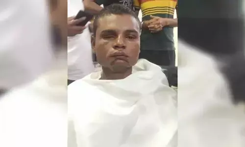Big News: नौकरी का झांसा देकर आंखें फोड़ीं, हाथ-पैर तोड़े, 70 हजार में भिखारी गैंग को बेचा, फिर एसे हुआ खुलासा Big News: नौकरी का झांसा देकर आंखें फोड़ीं, हाथ-पैर तोड़े, 70 हजार में भिखारी गैंग को बेचा, फिर एसे हुआ खुलासा