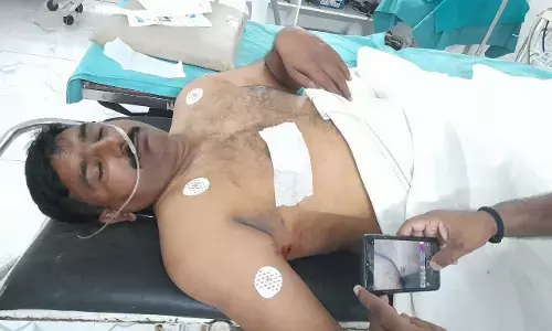 वाराणसी में दरोगा को वाइक सवार ने मारी गोली, पुलिस महकमें में मची सनसनी