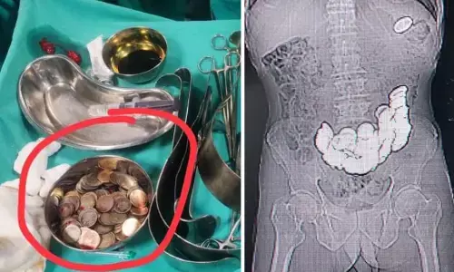 पेट दर्द हुआ तो डॉक्टर के पास गया शख्स, एक्सरे में निकली ऐसी चीजें देखकर सुन्न पड़ गया दिमाग