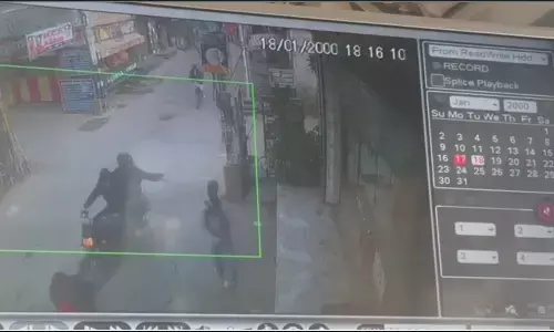 Delhi Acid Attack: दिनदहाड़े द्वारका में छात्रा पर एसिड अटैक, बाइक सवार दो सिरफिरे तेजाब फेंक भागे, देखें Video