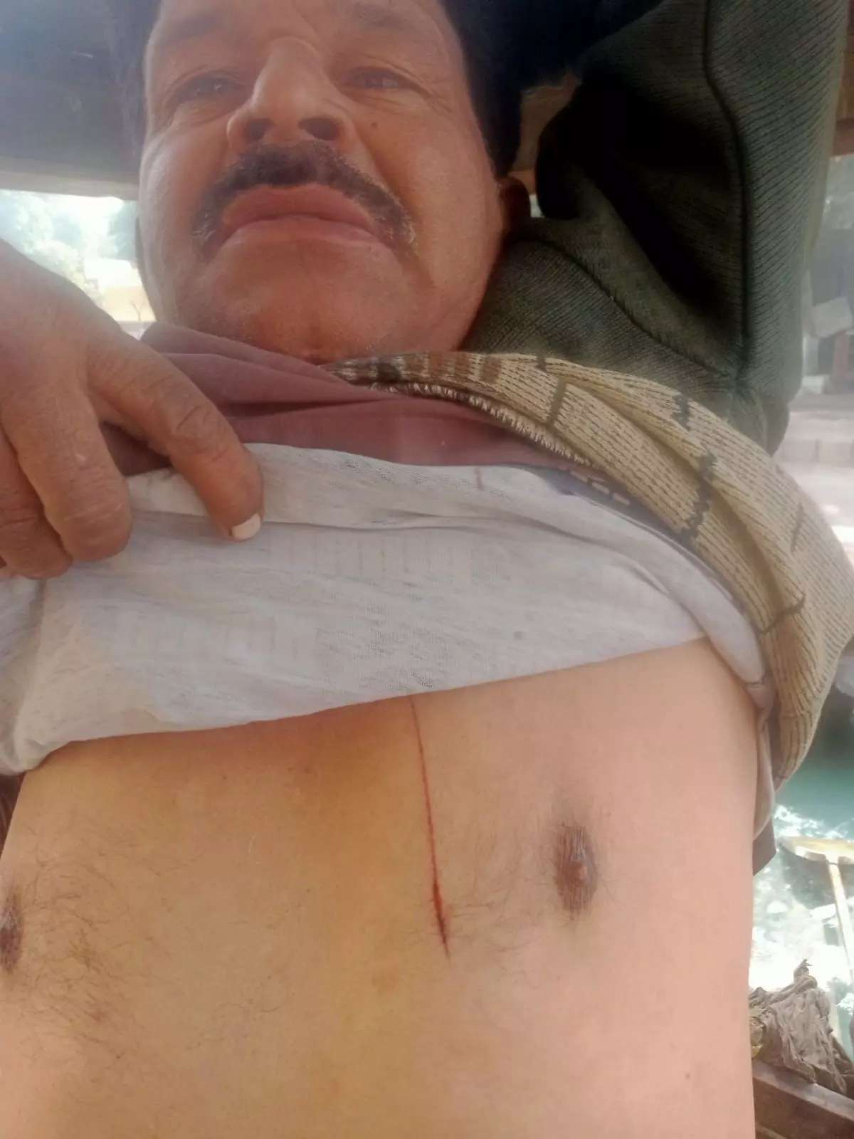 गाजियाबाद के मोदीनगर में घर के बाहर खड़े युवक पर दबंगों ने किया जानलेवा हमला विडियो वायरल