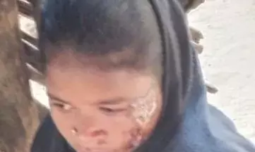 बस्तर के बुर्जी और कुंदेड़ में पुलिस कैंप का विरोध कर रहे आदिवासियों पर पुलिस के हमले की किसान सभा ने की निंदा बस्तर के बुर्जी और कुंदेड़ में पुलिस कैंप का विरोध कर रहे आदिवासियों पर पुलिस के हमले की किसान सभा ने की निंदा